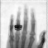 Roentgen